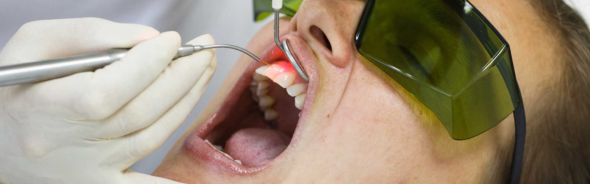 NE Calgary Dental Laser Therapy | Pathways Dental Clinic