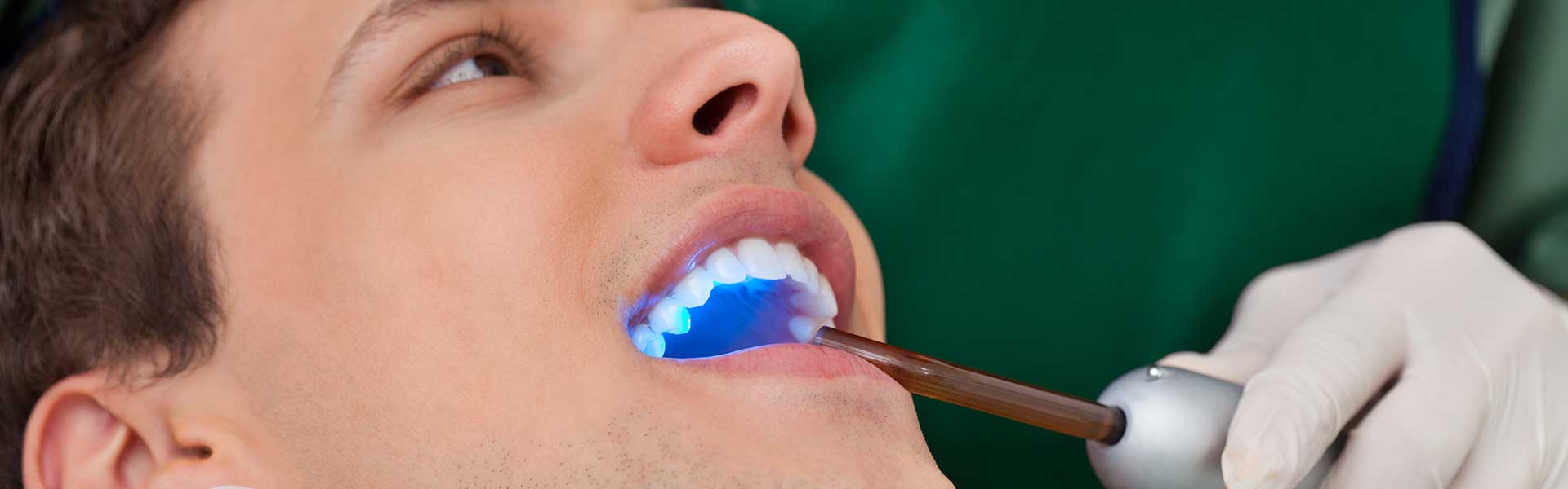 NE Calgary Tooth Bonding | Pathways Dental Clinic